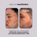 NOVO: Kit Cuidado Facial - Proper Jack - Kit Skincare Masculino - Prevenção de Acne e Saúde p/ Pele
